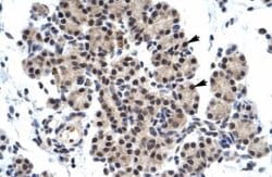 ZNF318 Rabbit anti-Human, Polyclonal, Novus Biologicals 100 &mu;g; Unconjugated:Antibodies,